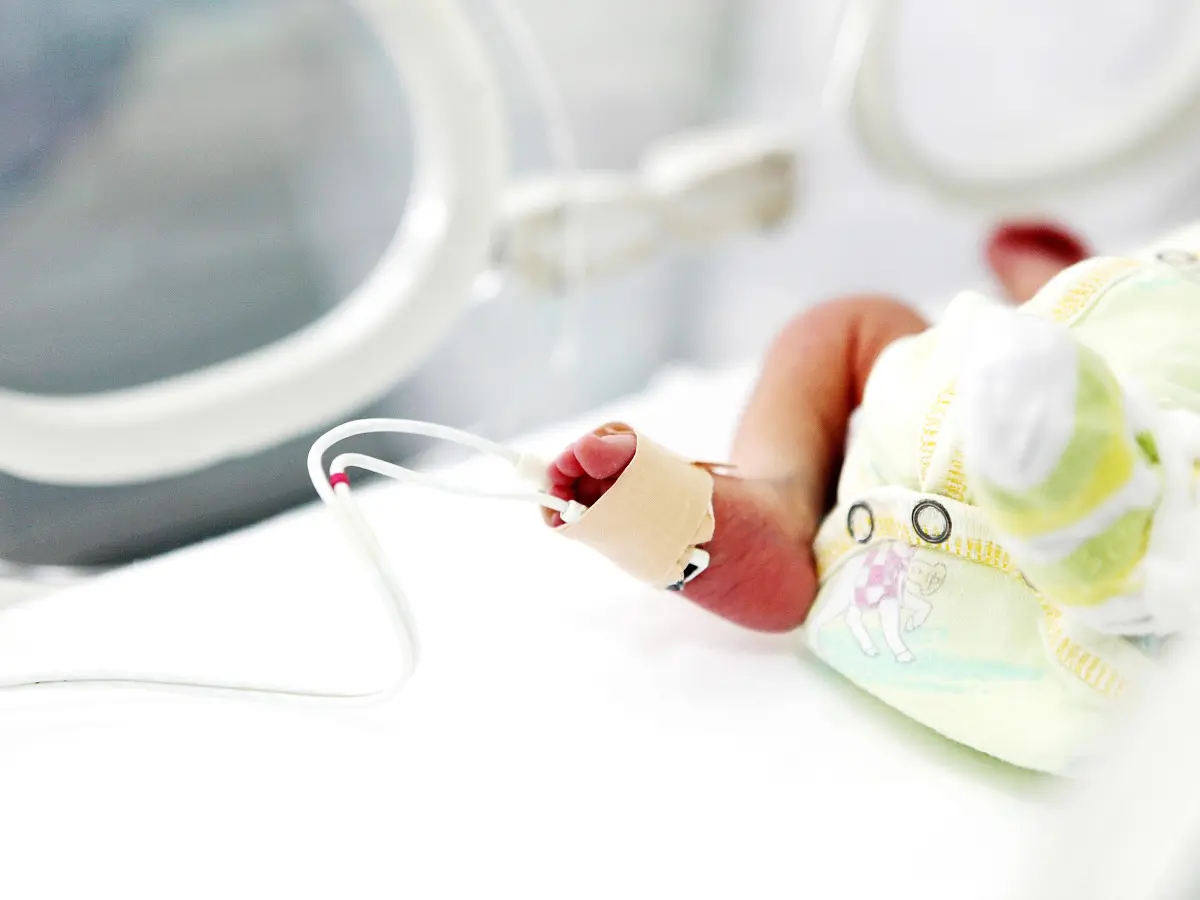 The foot of a nicu baby in the hospital with leads and wires everywhere.