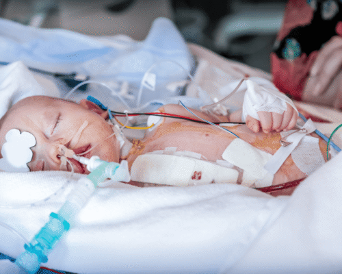 Newborn resting in a hospital bed with medical tubes, monitors, and bandages, receiving intensive care after surgery or a serious medical condition
