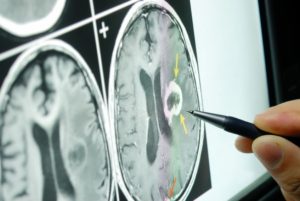 Brain scan on a lightboard