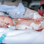 Newborn resting in a hospital bed with medical tubes, monitors, and bandages, receiving intensive care after surgery or a serious medical condition