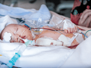 Newborn resting in a hospital bed with medical tubes, monitors, and bandages, receiving intensive care after surgery or a serious medical condition